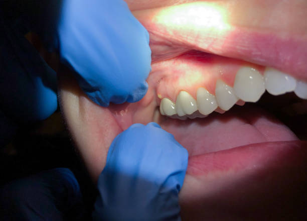 Best Pediatric Emergency Dentist in Millwood, WA